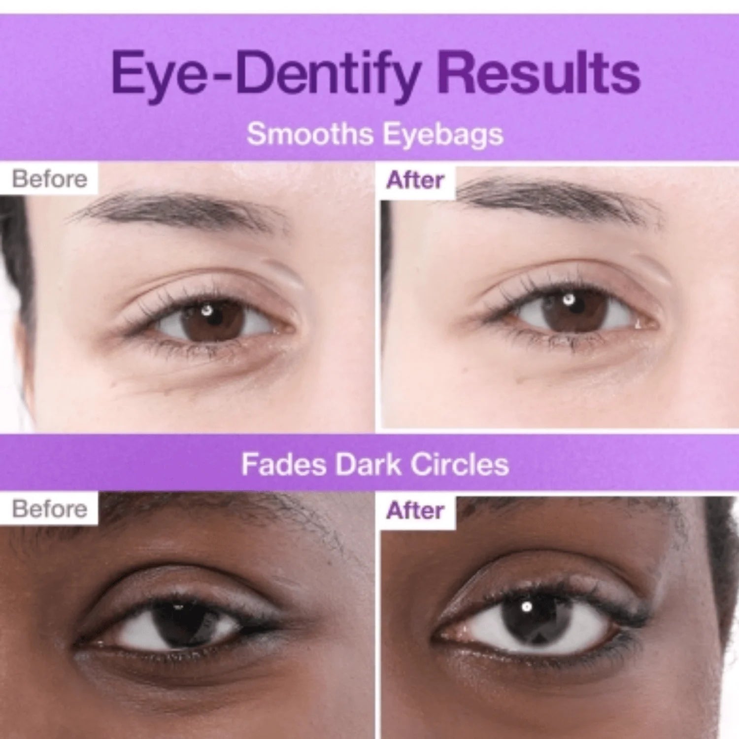 Numbuzin No.9 NAD Under Eye Patches (5ea)